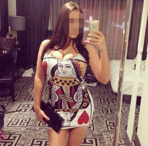 Arguvan Escort Bayan Damla – Randevu